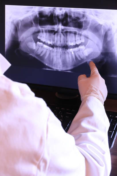 Best Emergency Wisdom Teeth Removal in Holbrook, AZ